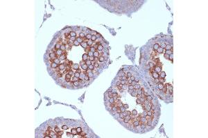 Immunohistochemistry of paraffin-embedded rat testis using KIF3A Rabbit mAb (ABIN7268132) at dilution of 1:100 (40x lens).