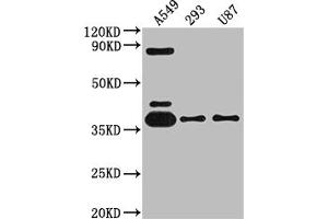 Western Blot Positive WB detected in: A549 whole cell lysate, 293 whole cell lysate, U87 whole cell lysate All lanes: ADORA1 antibody at 1:2000 Secondary Goat polyclonal to rabbit IgG at 1/50000 dilution Predicted band size: 37, 14 kDa Observed band size: 37 kDa (Recombinant ADORA1 anticorps)