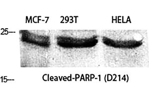 Western Blot analysis of MCF-7 (1), 293T (2), Hela (3), diluted at 1:2000. (PARP1 anticorps  (Cleaved-Asp214))
