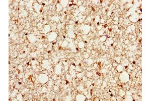 IHC image of ABIN7164840 diluted at 1:500 and staining in paraffin-embedded human brain tissue performed on a Leica BondTM system.