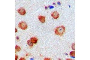 Immunohistochemical analysis of CDK6 staining in human brain formalin fixed paraffin embedded tissue section.