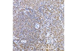 Immunohistochemistry of paraffin-embedded rat spleen using Snail Rabbit pAb (ABIN1682836, ABIN3019402, ABIN3019403, ABIN3019404 and ABIN6220883) at dilution of 1:150 (40x lens).