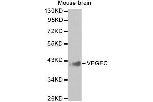 Western Blotting (WB) image for anti-Vascular Endothelial Growth Factor C (VEGFC) antibody (ABIN6219656) (VEGFC anticorps)