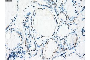 Immunohistochemical staining of paraffin-embedded Ovary tissue using anti-CRYABmouse monoclonal antibody. (CRYAB anticorps)