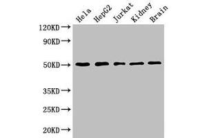 Western Blot Positive WB detected in: Hela whole cell lysate, HepG2 whole cell lysate, Jurkat whole cell lysate, Mouse kidney tissue, Mouse brain tissue All lanes: TUBA3C antibody at 3 μg/mL Secondary Goat polyclonal to rabbit IgG at 1/50000 dilution Predicted band size: 50, 47 kDa Observed band size: 50 kDa (TUBA3C anticorps  (AA 161-418))