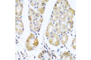 Immunohistochemistry of paraffin-embedded human stomach using MRPL11 antibody.