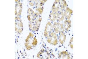 Immunohistochemistry of paraffin-embedded human stomach using MRPL11 antibody. (MRPL11 anticorps  (AA 1-192))