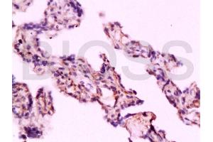 Formalin-fixed and paraffin embedded human placenta labeled with Rabbit Anti TLR4/CD284 Polyclonal Antibody, Unconjugated (ABIN736491) at 1:200 followed by conjugation to the secondary antibody and DAB staining