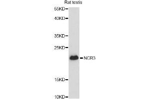 Western blot analysis of extracts of rat testis, using CALM3 antibody. (Calmodulin 3 anticorps)