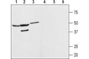 Western blot analysis of rat brain (lanes 1 and 4) kidney (lanes 2 and 5) and heart (lanes 3 and 6) membranes: - 1-3.