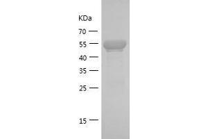 Western Blotting (WB) image for Nuclear Factor of kappa Light Polypeptide Gene Enhancer in B-Cells Inhibitor, alpha (NFKBIA) (AA 7-266) protein (GST tag) (ABIN7124205)