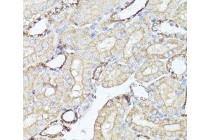Immunohistochemistry of paraffin-embedded Mouse kidney using OPRK1 Polyclonal Antibody at dilution of 1:100 (40x lens).