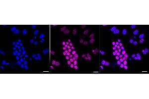 Immunocytochemical staining of Hela cells with E2F6 antibody (ABIN7798416), 1:1,000).