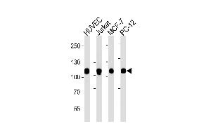 Western blot analysis of lysates from HUVEC, Jurkat, MCF-7, PC-12 cell line (from left to right), using TOP1 Antibody (N-term) (ABIN1882055 and ABIN2838496). (Topoisomerase I anticorps  (N-Term))