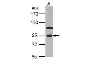 anti-Component of Oligomeric Golgi Complex 7 (COG7) (AA 7-286) antibody