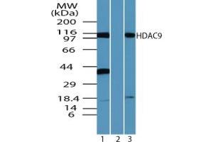 Image no. 2 for anti-Histone Deacetylase 9 (HDAC9) (AA 100-150) antibody (ABIN960197) (HDAC9 anticorps  (AA 100-150))