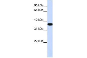 Heme Oxygenase antibody used at 1 ug/ml to detect target protein. (Heme Oxygenase anticorps)