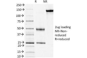 SDS-PAGE Analysis Purified CD3e Mouse Monoclonal Antibody (PC3/188A). (CD3 epsilon anticorps  (Cytoplasmic Domain))