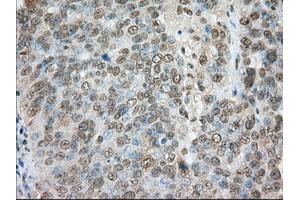 Immunohistochemical staining of paraffin-embedded colon tissue using anti-TACC3 mouse monoclonal antibody. (TACC3 anticorps)