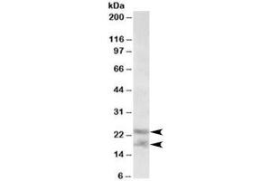 Western blot testing of human prostate lysate with IL-25 antibody at 0. (IL-25 anticorps)