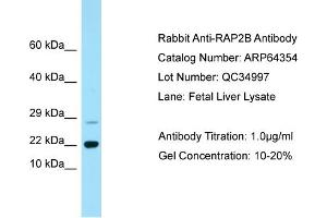 Western Blotting (WB) image for anti-RAP2B, Member of RAS Oncogene Family (RAP2B) (C-Term) antibody (ABIN2789814) (RAP2B anticorps  (C-Term))