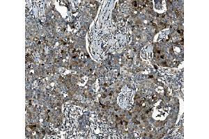 IHC analysis of SEC14L3/TAP2 using anti-SEC14L3/TAP2 antibody (ABIN7601623). (SEC14L3 anticorps  (AA 4-400))