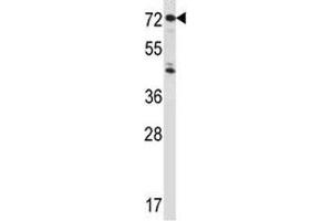 IL1R1 antibody western blot analysis in HepG2 lysate. (IL1R1 anticorps  (AA 422-450))