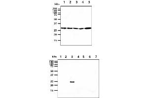 The cell lysates (40ug) were resolved by SDS-PAGE, transferred to PVDF membrane and probed with anti-human 14-3-3 epsilon antibody (1:1000). (YWHAE anticorps)