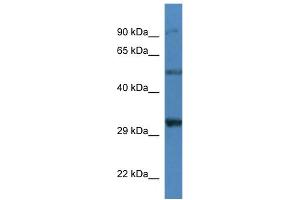 WB Suggested Anti-Sgcd Antibody   Titration: 1. (SGCD anticorps  (N-Term))