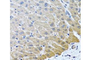 Immunohistochemistry of paraffin-embedded Human liver using ARSF Polyclonal Antibody at dilution of 1:100 (40x lens). (ARSF anticorps)