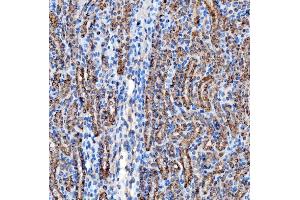 IHC analysis of RAB7/RAB7A using anti-RAB7/RAB7A antibody (ABIN7600597). (RAB7A anticorps  (AA 21-177))