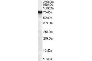 ABIN2562711 (1µg/ml) staining of human pancreas lysate (35µg protein in RIPA buffer). (FZD8 anticorps  (C-Term))