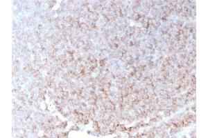 Formalin-fixed, paraffin-embedded human spleen stained with CD21 Recombinant Mouse Monoclonal Antibody (rCR2/1952).