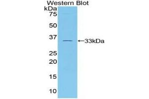 Western blot analysis of the recombinant protein. (TUBB1 anticorps  (AA 182-437))