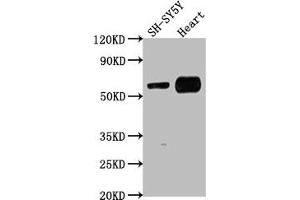 Western Blot Positive WB detected in: SH-SY5Y whole cell lysate, Mouse heart tissue All lanes: JRK antibody at 1:1000 Secondary Goat polyclonal to rabbit IgG at 1/50000 dilution Predicted band size: 62, 63 kDa Observed band size: 62 kDa (JRK anticorps  (AA 465-483))