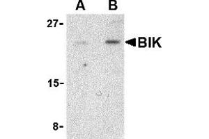 Western Blotting (WB) image for anti-BCL2-Interacting Killer (Apoptosis-Inducing) (BIK) (N-Term) antibody (ABIN1031274) (BIK anticorps  (N-Term))