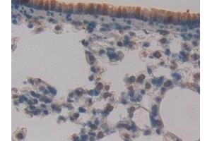 anti-Ataxia Telangiectasia Mutated (ATM) (AA 486-742) antibody