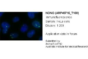 Image no. 6 for anti-Non-POU Domain Containing, Octamer-Binding (NONO) (C-Term) antibody (ABIN2779028) (NONO anticorps  (C-Term))
