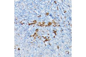 Immunohistochemistry of paraffin-embedded rat spleen using STING antibody (ABIN7270958) at dilution of 1:25 (40x lens).