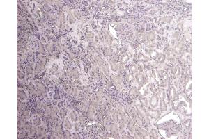 (ABIN184756) Negative Control showing staining of paraffin embedded Human Kidney, with no primary antibody.