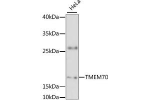 Western blot analysis of extracts of HeLa cells, using TMEM70 antibody (ABIN6294170) at 1:3000 dilution. (Transmembrane Protein 70 (TMM70) anticorps)
