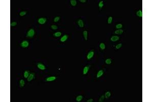 Immunofluorescent analysis of Hela cells using ABIN7142846 at dilution of 1:100 and Alexa Fluor 488-congugated AffiniPure Goat Anti-Rabbit IgG(H+L) (NIP7 anticorps  (AA 1-180))