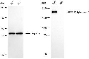Western blotting analysis using polybromo 1 antibody (ABIN7799873). (Recombinant Polybromo 1 anticorps)
