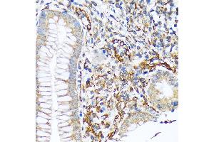 Immunohistochemistry of paraffin-embedded human appendix using Sec23AA Rabbit mAb (ABIN7270168) at dilution of 1:100 (40x lens). (SEC23A anticorps)