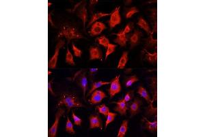 Immunofluorescence analysis of NIH/3T3 cells using ENO2 antibody. (ENO2/NSE anticorps  (AA 195-434))
