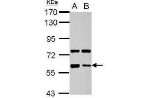 Western Blotting (WB) image for anti-Glypican 5 (GPC5) (AA 37-352) antibody (ABIN1498501) (GPC5 anticorps  (AA 37-352))