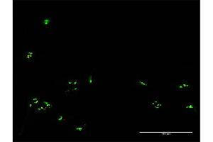 Immunofluorescence of purified MaxPab antibody to RBM19 on HeLa cell. (RBM19 anticorps  (AA 1-960))
