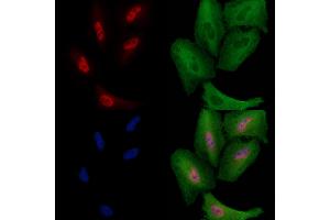ABIN6259975 and ABIN6278551 staining  cells by IF/ICC. (CDC23 anticorps  (Internal Region))