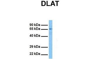 Host:  Rabbit  Target Name:  DLAT  Sample Tissue:  Human Jurkat  Antibody Dilution:  1. (DLAT anticorps  (N-Term))