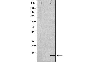 Western blot analysis of Mouse liver lysate, using DEFB132 Antibody. (DEFB132 anticorps)